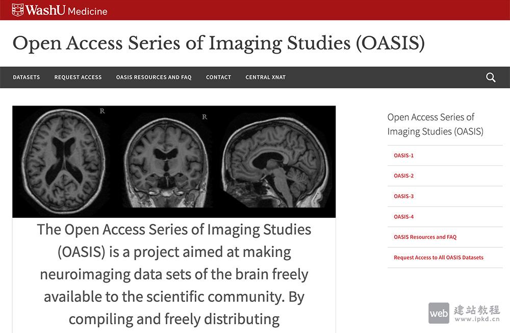 OASIS Brains：一个为正常老化和阿尔茨海默病研究提供多模态神经影像数据的项目